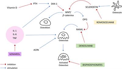 Osteoporosis in Inflammatory Arthritides: New Perspective on Pathogenesis and Treatment